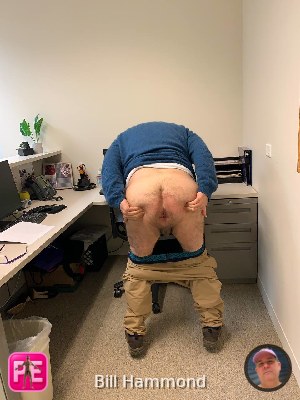 asshole